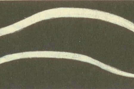 Фото Askaris lumbricoides Фото Askaris lumbricoides