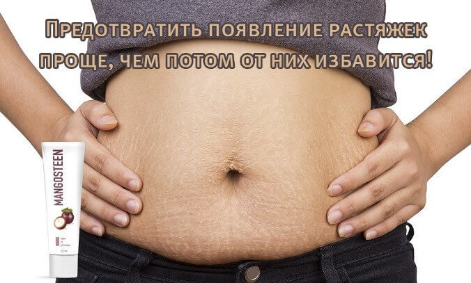 Крем від розтяжок Mangosteen Крем від розтяжок Mangosteen