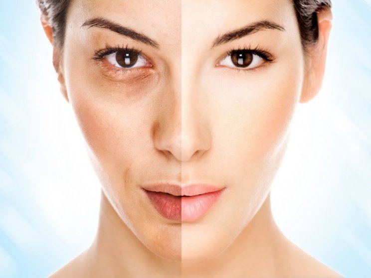 Відбілюючі маски для обличчя в домашніх умовах Відбілюючі маски для обличчя в домашніх умовах