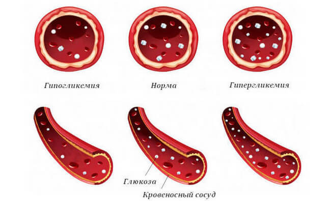 Рівень цукру в крові: норми і відхилення Рівень цукру в крові: норми і відхилення