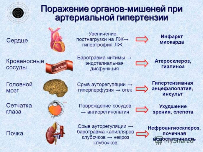 Артеріальна гіпертензія (гіпертонія): симптоми, лікування Артеріальна гіпертензія (гіпертонія): симптоми, лікування