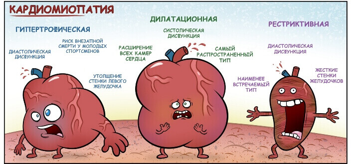Класифікація кардіоміопатій Класифікація кардіоміопатій