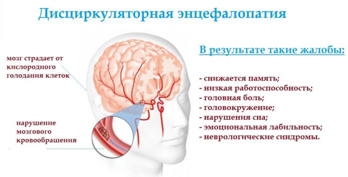 Лікування коклюшу у дітей в домашніх і лікарняних умовах Лікування коклюшу у дітей в домашніх і лікарняних умовах