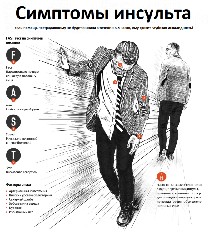Ішемічний інсульт головного мозку симптоми Ішемічний інсульт головного мозку симптоми