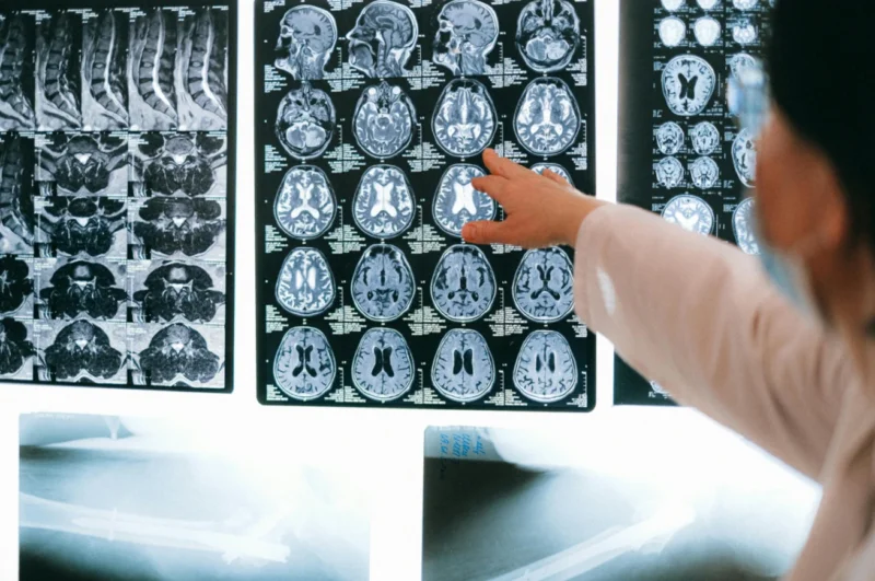 Неврологія в Harmony Health: консультація спеціаліста та запис на прийом для точної діагностики